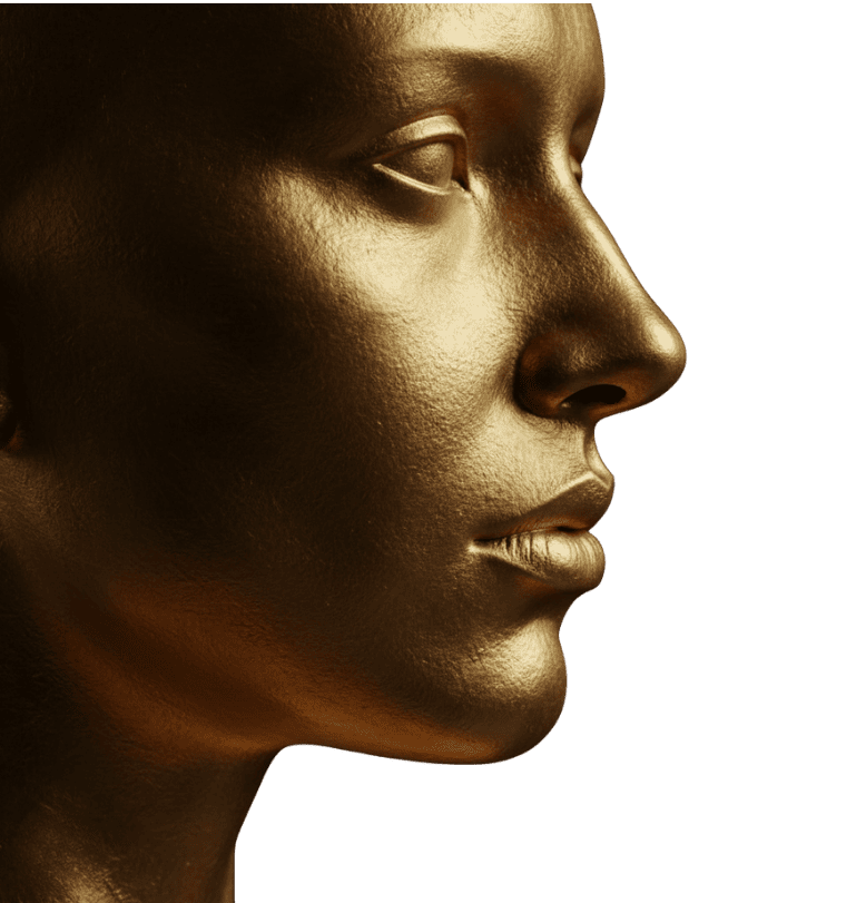 Rinoplastia en Colombia (Rhinoplasty) - Perfil nasal estético y funcional por el Dr. Chanchí